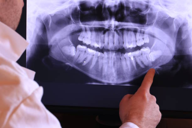 Best Emergency Tooth Extraction in Liberty Triangle, FL