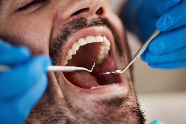Best Emergency Treatment for Toothache in Liberty Triangle, FL