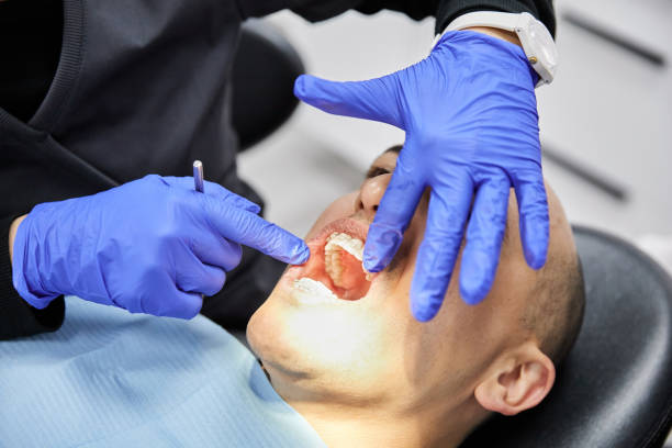 Best Emergency Tooth Extraction in Liberty Triangle, FL